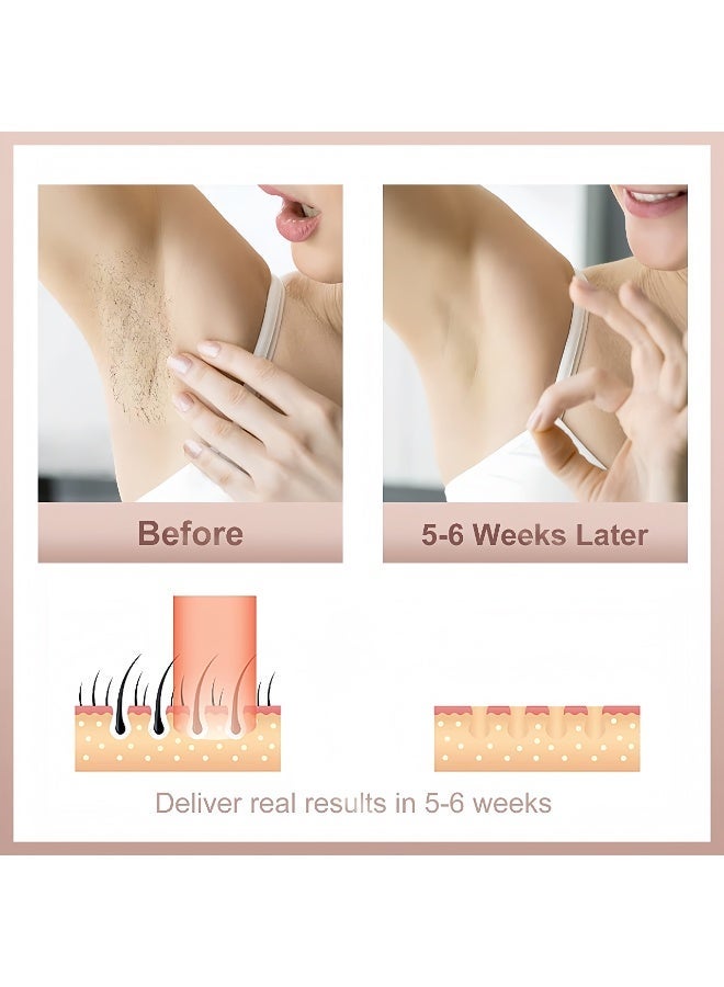 XiuWoo IPL Hair Removal,Laser Hair Removal At-Home,Painless Laser Hair Removal Device,Home Hair Remover with Glasses,999,999 Flashes Permanent Hair Removal Device,Portable Permanent Hair Reduction,on Facial Legs Arms Bikini Line,For Women & Men - Image 3